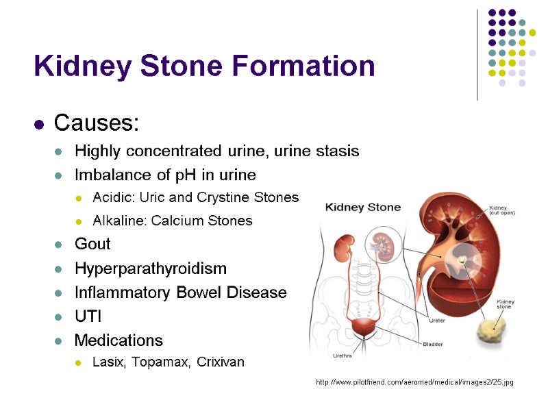Kidney Stone Formation Causes: Highly concentrated urine, urine stasis Imbalance of pH in urine